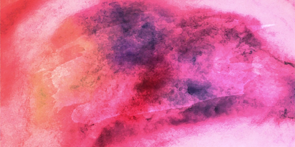 Modafinil in Spain: A Rising Trend Among Students And Professionals