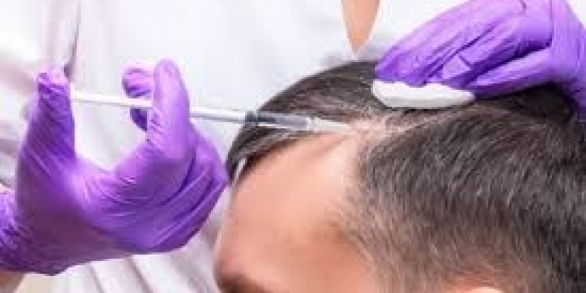 ما هي أهم مميزات زراعة الشعر؟